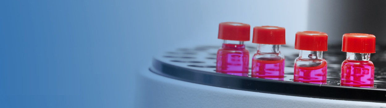 Servicio Técnico Cromatografía